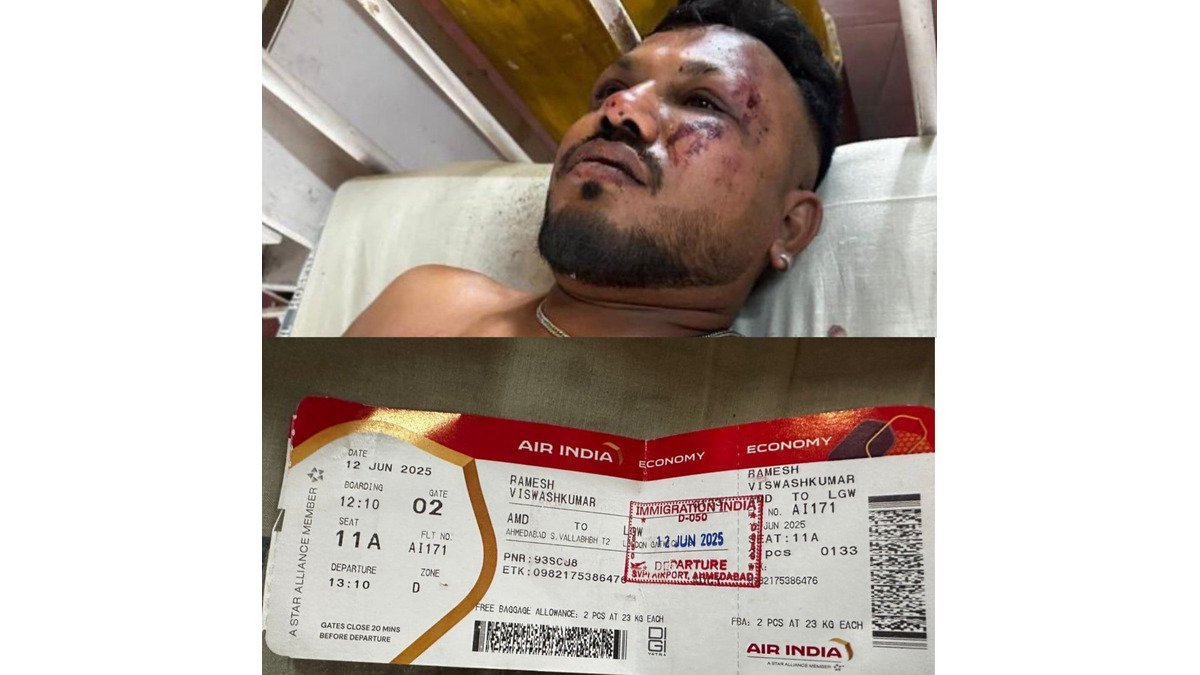 Vishwash Kumar Ramesh 1 Man who Survived Ahmedabad Flight Crash