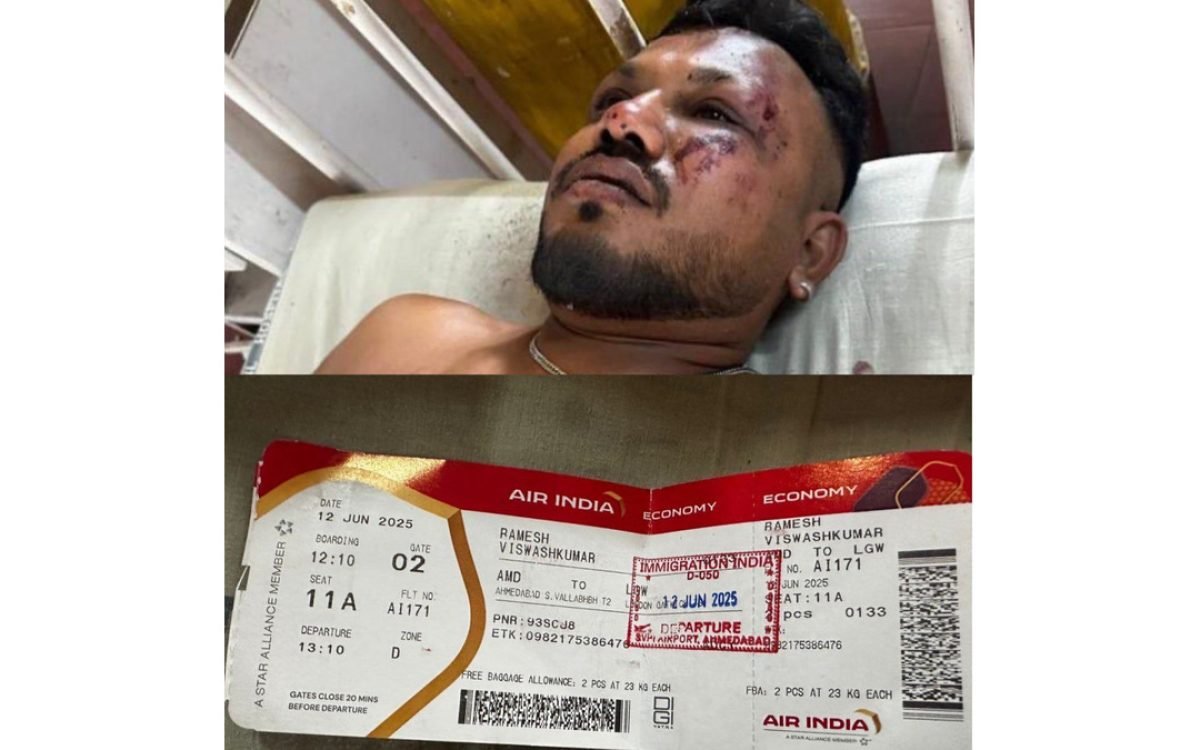 Vishwash Kumar Ramesh 1 Man who Survived Ahmedabad Flight Crash